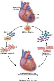 JPrevMed3's tweet photo. Does #Mental Health Differ by #Ethnicity/Race in #Post-Myocardial Infarction (MI) Females Ages 50 Years and Older?.. Visit https://t.co/UF7sk8XZO7 any valuable paper ? Submit to #preventivemed@emedicaljournals.org https://t.co/taeKolu4db
