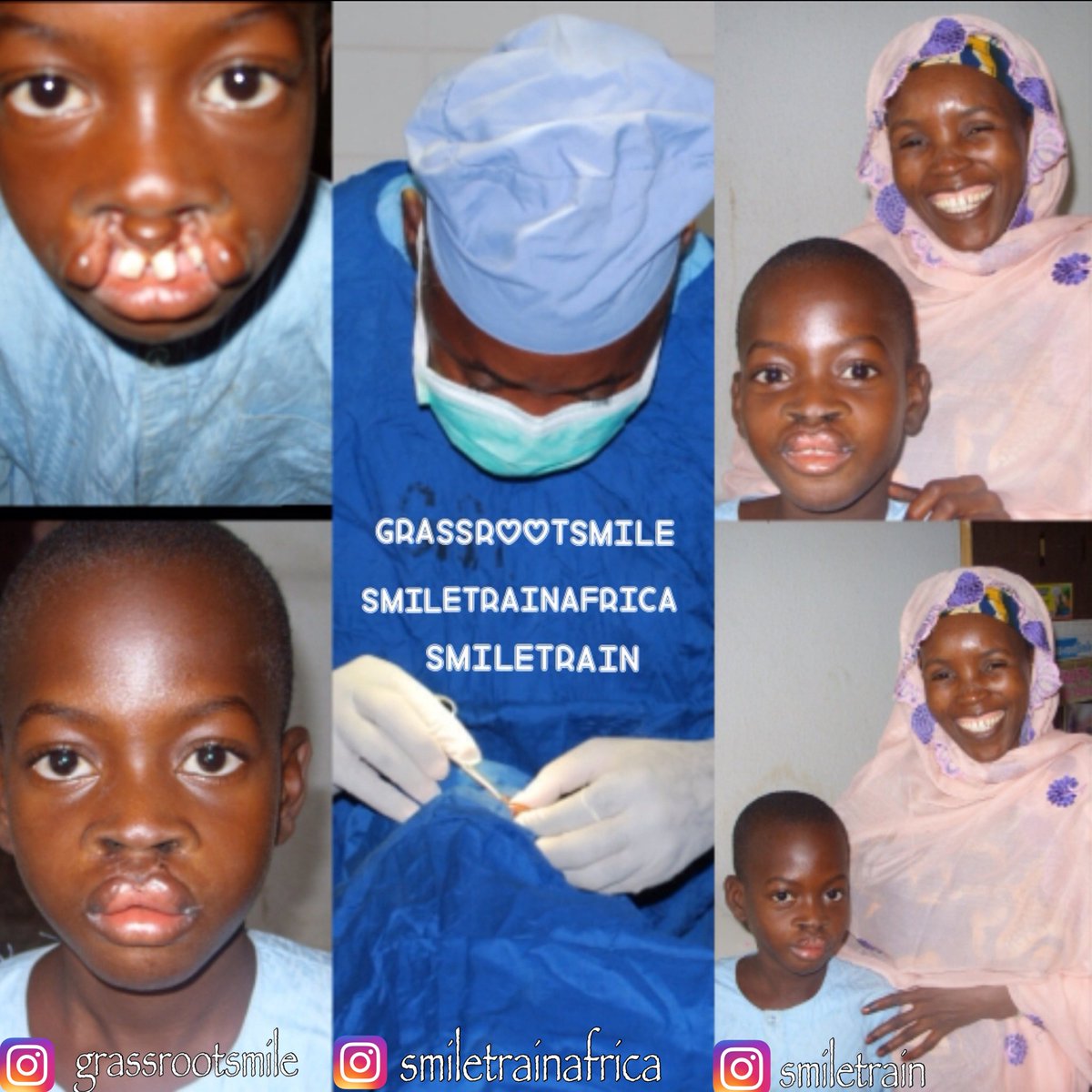 Please help us like and retweet Alhassan Abdulraham's picture and help him win an award this October from <a href="/SmileTrainAfric/">Smile Train Africa</a> for the best smile in Africa. #SmileTrainAfricaSmiles #mondaymotivation #alhassansmiles Our helpers are on your timeline❤😊