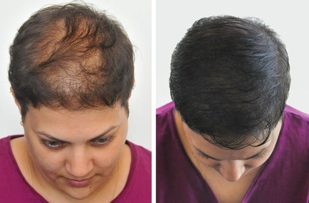 puncto7's tweet image. 