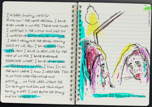 IDMethProject's tweet image. Scabs, rotting teeth, acne. Meth can do some terrible things to your appearance. Make the right choice. #NotEvenOnce