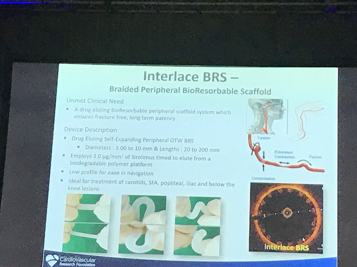 cuspcancerleo's tweet photo. First gen of peripheral BRS are now getting tested in human clinical trials!      Pipeline #Melange #Credence #Interlace #BRS devices by @MerilLife will be soon available for physicians to use in routine practice! @famadorDRG @Ashishb_DRG @SnarendraDRG @aditichada @DRGMedtech https://t.co/NlOU17ir4e