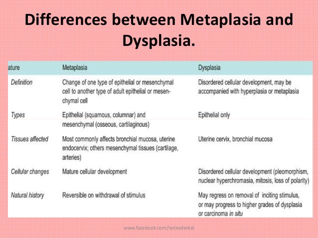 Metaplasia and dysplasia: Video, Anatomy & Definition