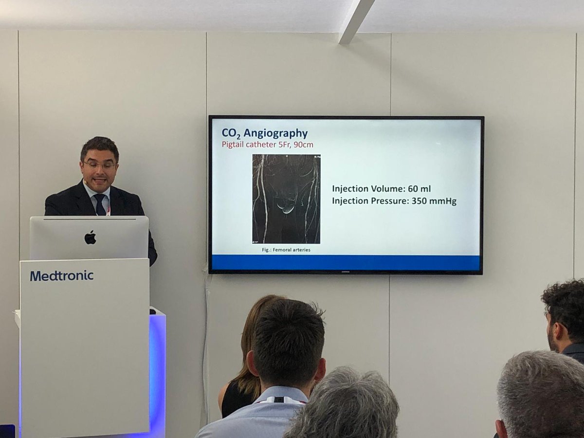 Dr. Theodosios Bisdas (@dr_bisdas) on Twitter photo A contrast-free cath lab should be always available in dedicated CLI centers. In CRITISCH registry every fourth patient had impaired renal function! #clifighters #critisch @K_Stavroulakis #CLIfightersEU #ANGIODROID <a href="/Vascupedia_com/">Vascupedia</a> <a href="/Mustapja/">Tegguer Mustapja</a> A contrast-free cath lab should be always available in dedicated CLI centers. In CRITISCH registry every fourth patient had impaired renal function! #clifighters #critisch @K_Stavroulakis #CLIfightersEU #ANGIODROID <a href="/Vascupedia_com/">Vascupedia</a> <a href="/Mustapja/">Tegguer Mustapja</a>