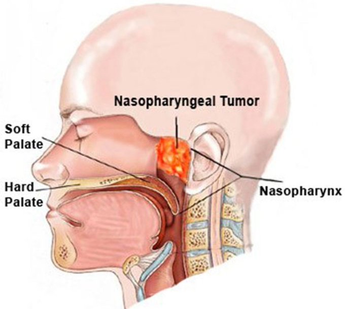 View image on Twitter