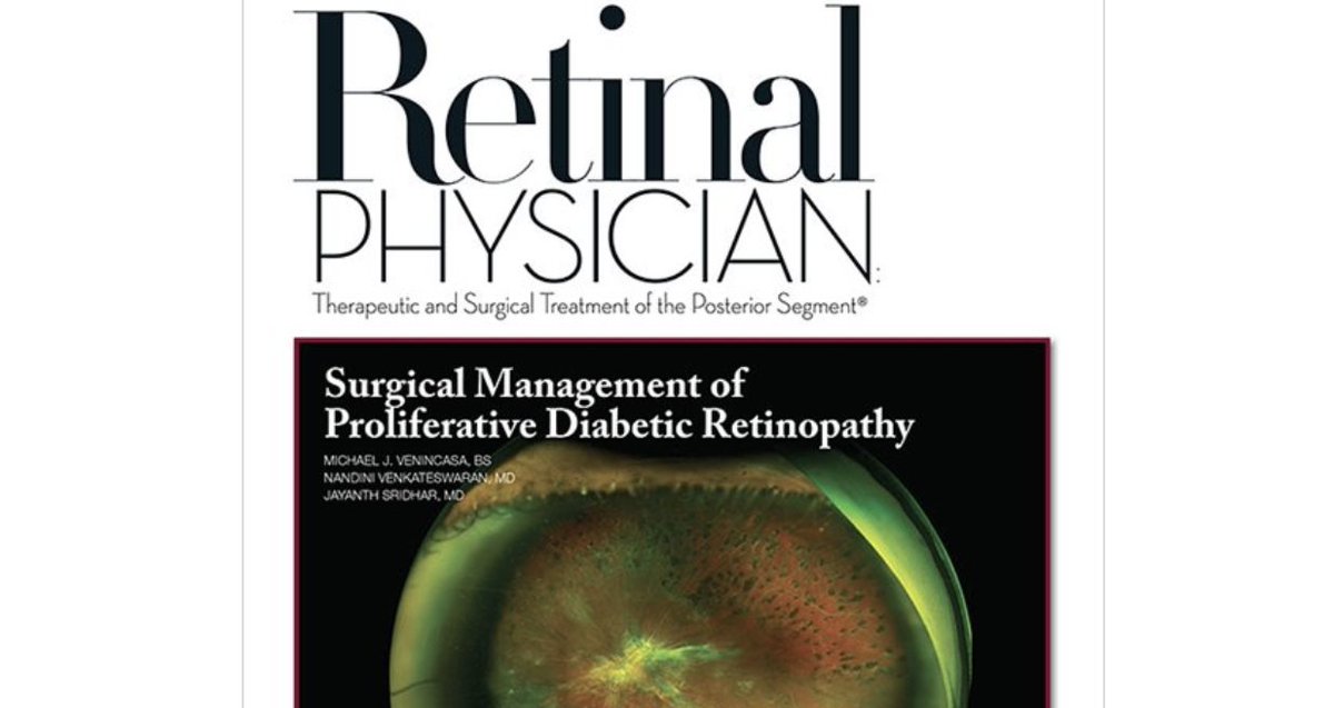 RetinalPhys's tweet photo. Subthreshold Laser Treatment of Retinal Diseases: A potential alternative for treating center-involving macular edema.https://t.co/BcaAbnfmUV #subthresholdlaser https://t.co/ya1IzIFFGj