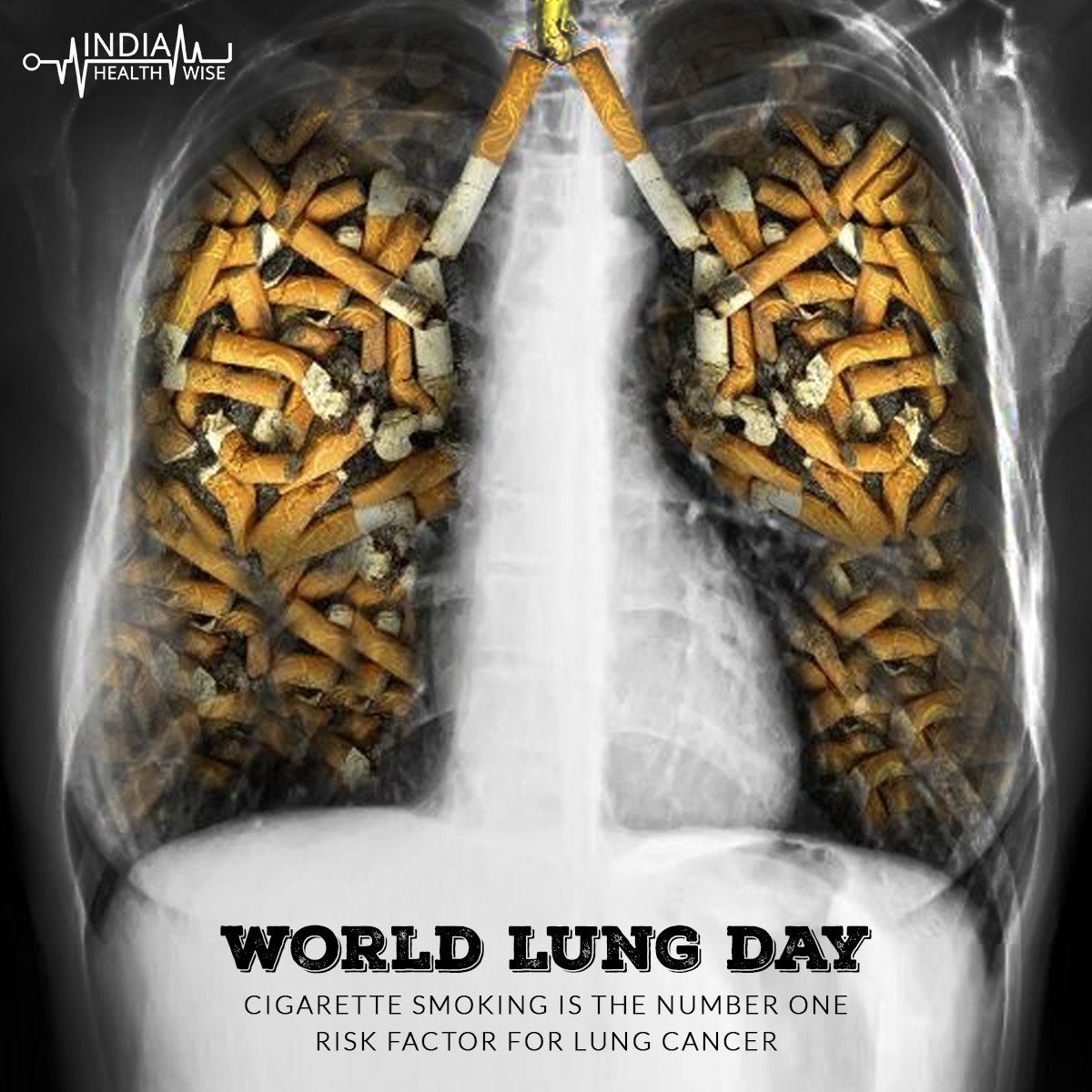 does cigarette smoking cause osteoporosis Does Smoking Cause Osteoporosis?