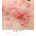 Photo by Dermatology in practice (@DermatologyIP)
