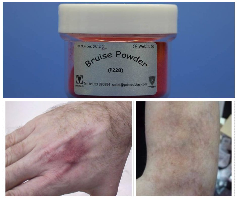 PrincipalityFX's tweet photo. Create realistic bruises with our Bruise Powder, available in 5g or 50g. https://t.co/lK4xQEvgS2

#bruisepowder #sfxmakeup #Principalitysfx #makeup #specialeffectsmakeup https://t.co/htq2pSD850