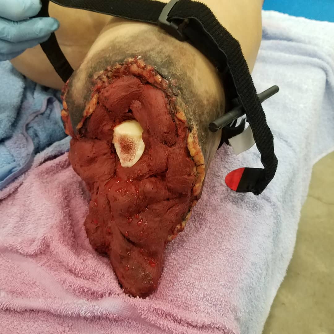 IndianapolisEMS's tweet image. Teaching #StoptheBleed can be messy at #jajobspark #whenigrowup