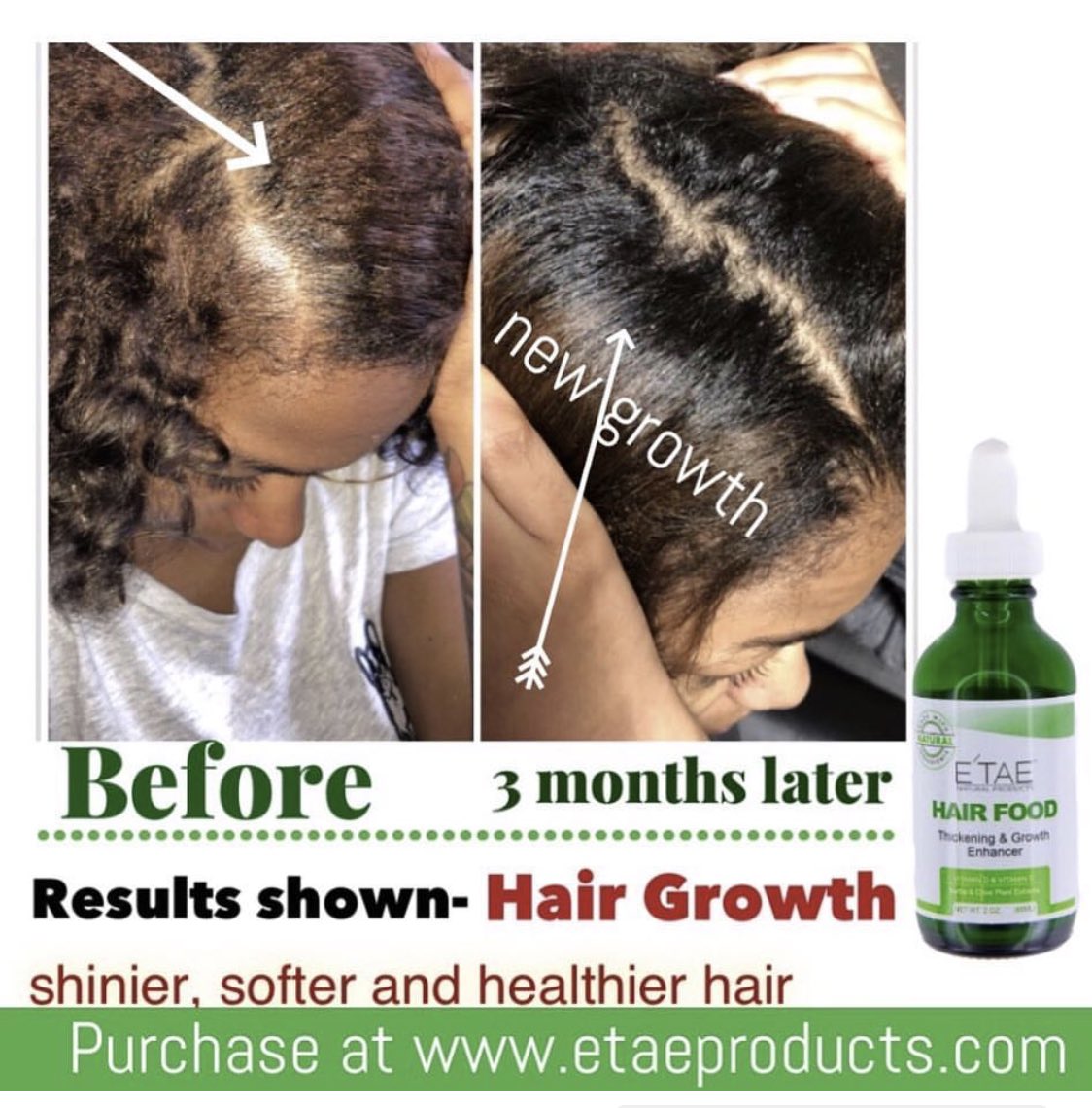 E Tae Natural Products On Twitter Purchase Your Bottle Of Hair