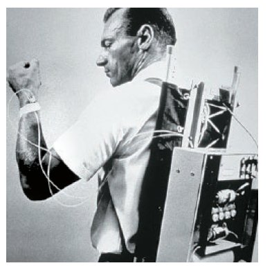 4 best u/amdiabetesassn images on Pholder | #DYK in 1963 the first ...