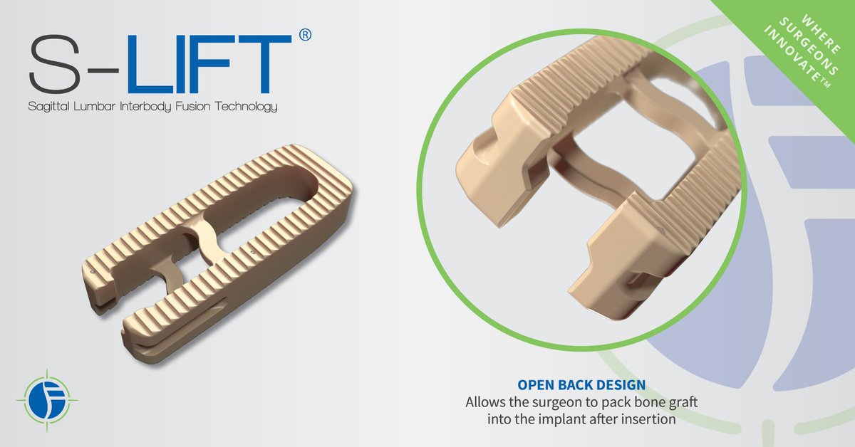 SpineFrontier's tweet photo. And tomorrow it begins. Join us at #NASS2018 to discover the difference in #LessExposureSurgery - as we feature our sagittal interbody #fusion technology, among our portfolio of #LES. Don't miss us @ booth #2429 for all things #spinal innovation. #NASS #NASS18 #spine #orthopedics https://t.co/XjCBA2iRuC