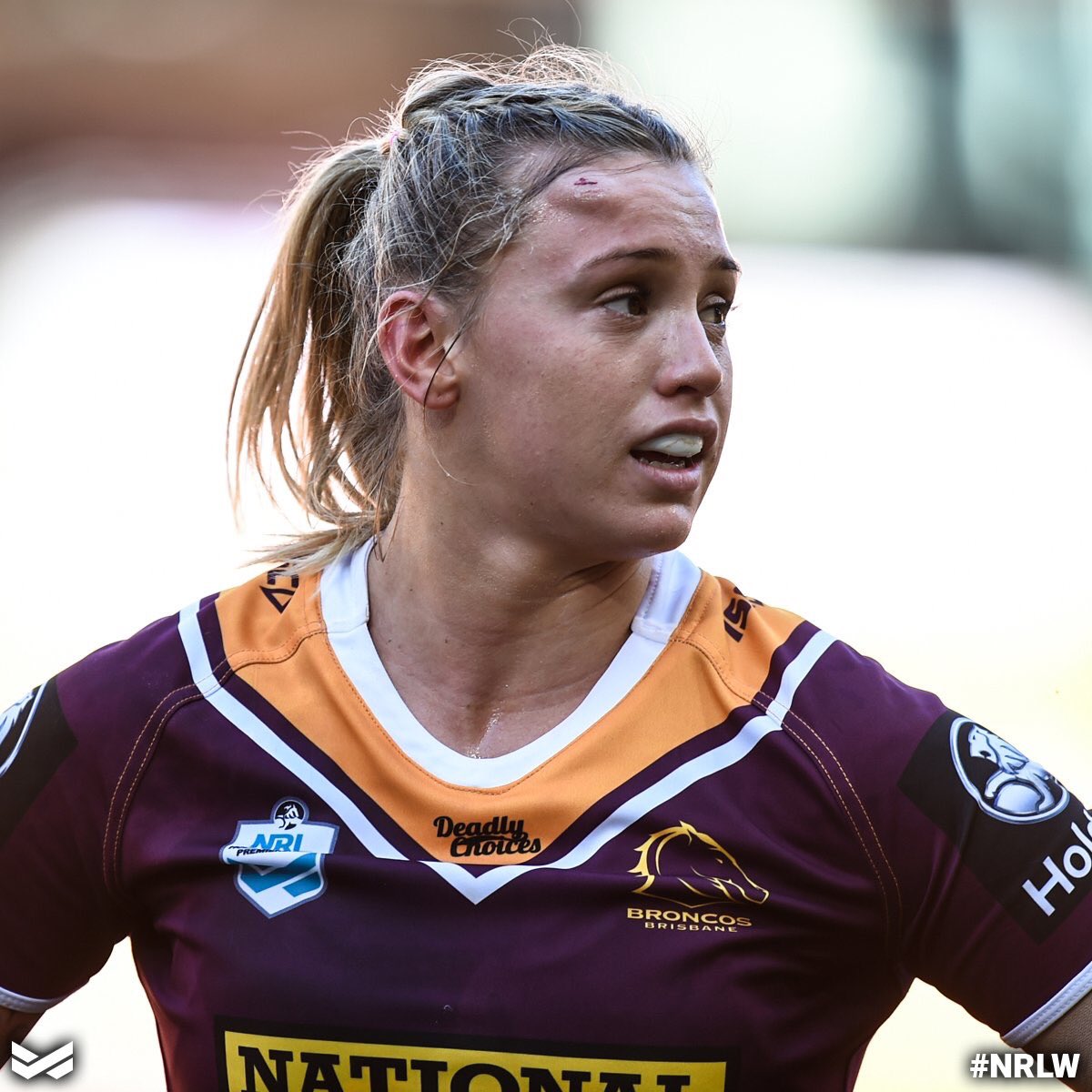 NRL PHYSIO On Twitter adlindley Wasn t Taken Off I Don t Think Was nrl-physio-on-twitter-adlindley-wasn-t-taken-off-i-don-t-think-was