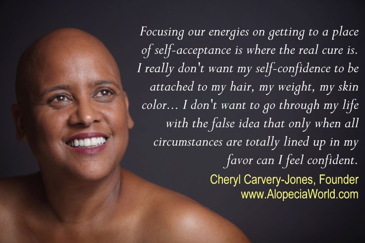 Focus your energy on getting to a place of Self-Acceptance
alopeciaworld.com/photo/img-0824…