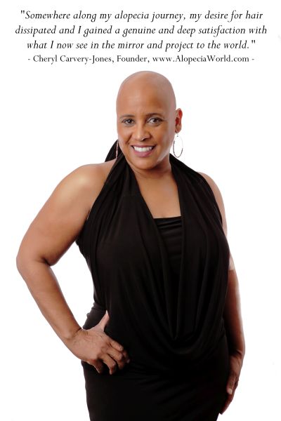 Free to be me - Alopecia World: alopeciaworld.com/photo/free-to-…