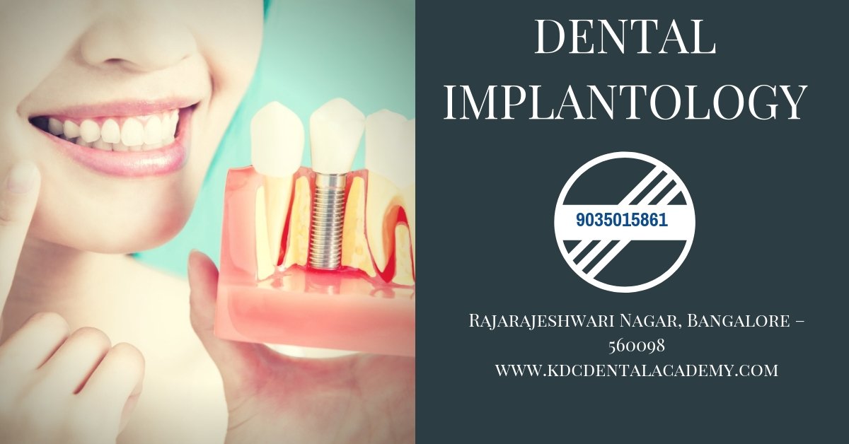 DentalAcademy2's tweet image. Dental Implantology course in Bangalore
CBCT Reading, Bone Grafts, Immediate Implants, #FullMouthImplants, Zygomatic Implants, #BasalImplants, All on Four Implants. For more info: kdcdentalacademy.com or call us: 9035015861