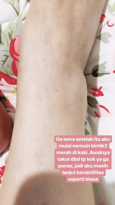 Ternyata Leukimia Inilah Thread Pengalaman Divonis Kanker