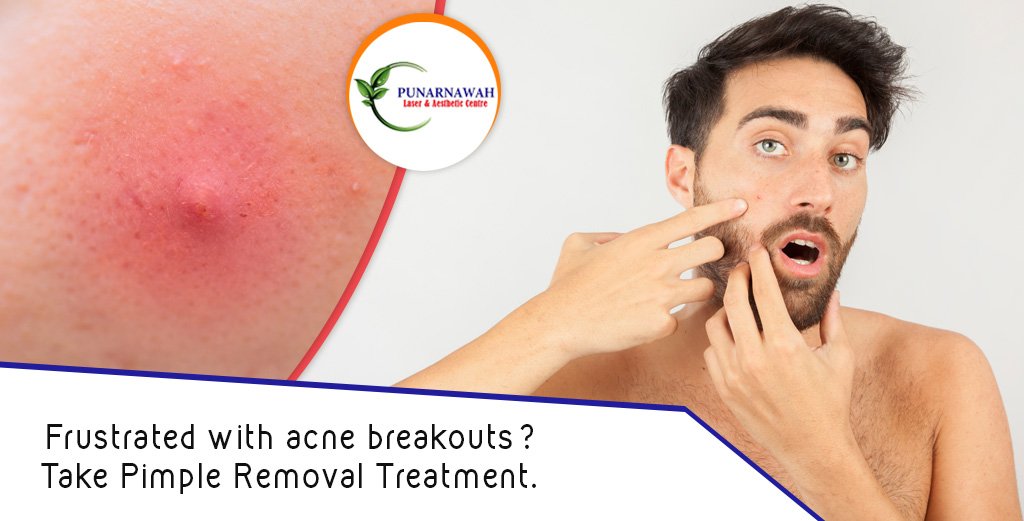 Frustrated with acne breakouts?

Take complete pimple Removal treatment.

#punarnawah #skincare #skintreatement #pimpletreatement #pimple #jaipur #rajasthan #friday