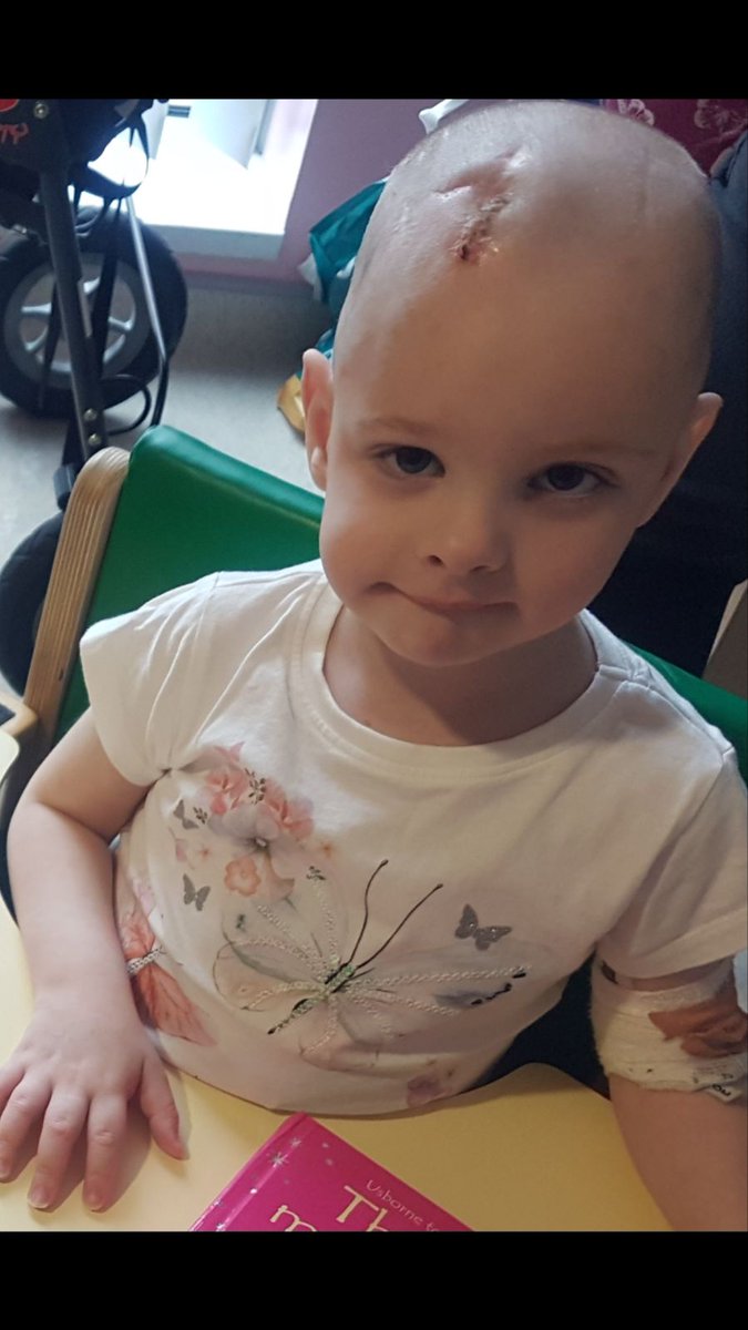 MFT_Charity's tweet photo. Brave Amelia has had over 150 scans and 50 brain surgeries @RMCHosp over the past four years.
Her family are dedicated to supporting our iMRI #ScannerAppeal. Read Amelia's story & find out how this new scanning equipment will help patients like her 👉
https://t.co/7TQhlqRsjY https://t.co/98yIfvLYEc
