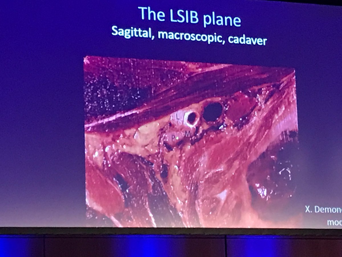 doc_sk's tweet photo. We have come a long way from early researchers stealing (literally) the bodies for anatomical dissection 2 having a 3D anatomical views of Human anatomy.. From #NerveStimulators to HR #UltrasoundMachines.
#History
#Research #HumanAnatomy #LearningFromTheExperienced #ESRA2018 https://t.co/xpvM1TsJGS
