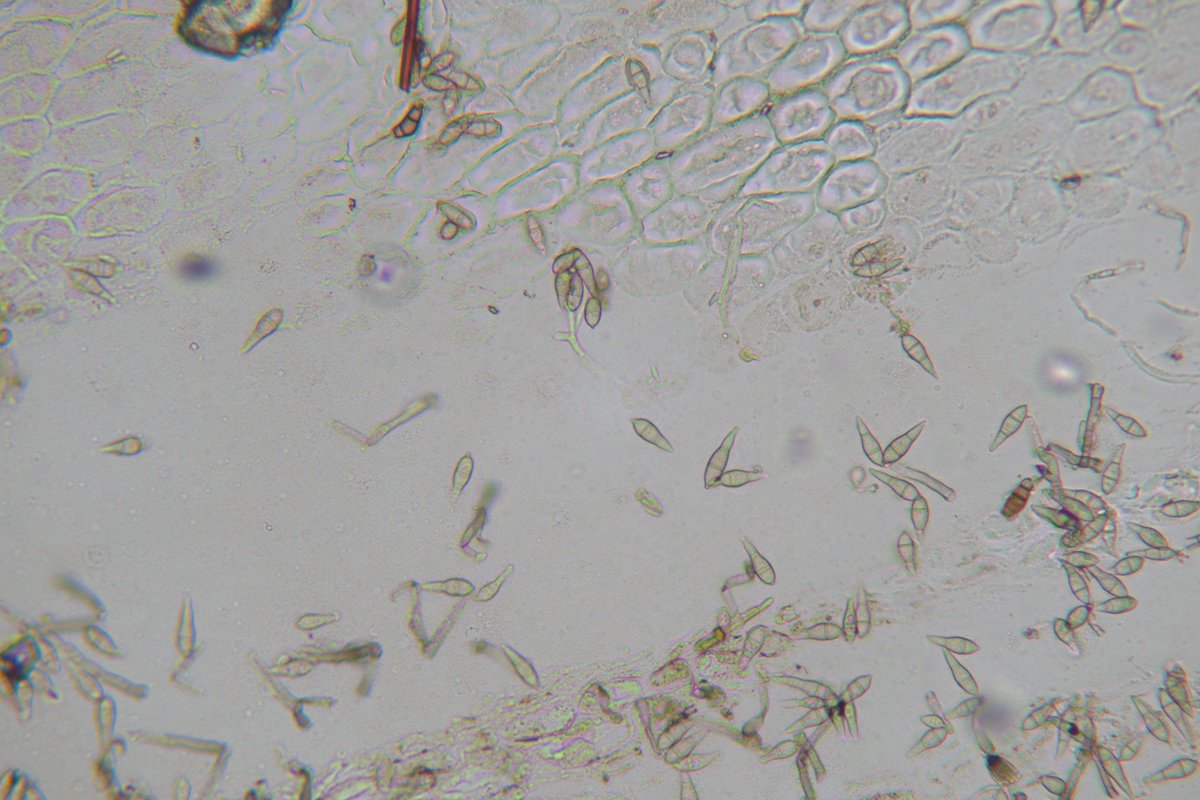 MSUextPlantLab's tweet image. The three amigos!  #StAugustinegrass with impressive leaf spots and leaf yellowing from the #GrayLeafSpot fungus Pyricularia grisea. #TakeAll root rot also is present; note the circuit-board type pattern the #Gaeumannoymyces hyphae and lobed hyphopodia make on the stolon. #MSUext
