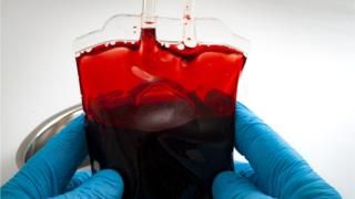 globalacademyhs's tweet image. Gut #bug #enzyme turns #blood into type-O 

#bacteria #researchers #Chemical 

buff.ly/2wkeXmE