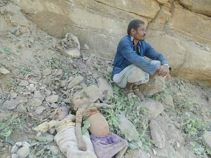 Marwa__Osman's tweet photo. Numbness... is what a parent feels at the sight of his lifeless children.
#YemenGenocide
#StopTheWarOnYemen
#StopAlSaud https://t.co/VAFCrQFsON