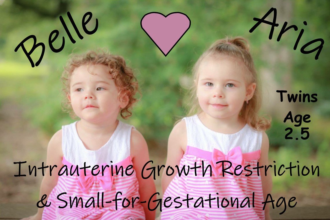 magicfoundation's tweet image. Small for Gestational Age generally describes any infant whose birth weight and/or birth length was less than the 3rd percentile, adjusted for prematurity (gestational age). 1 in 10 SGA children fail to achieve catch-up growth by age 2. bit.ly/2bCNTmw #MoreThanHeight