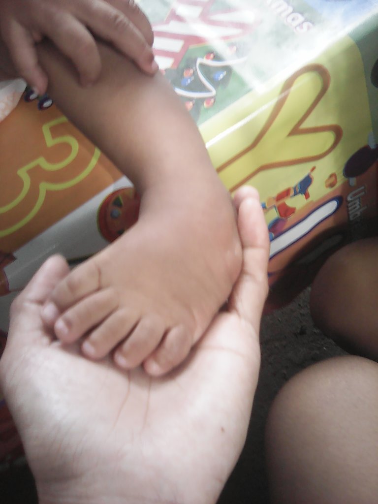 CaniteMelanie's tweet photo. @gofundme help me for my baby clubbedfoot.i have do not money yet casting i have a financial https://t.co/MYEZBSyIrg me. https://t.co/4tMlyldsoP