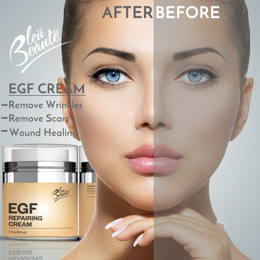 BleuBeaute's tweet photo. BB #EGF #RepairingCream β reduce #Wrinkles and heal Wound #Acne, #darkspot and scar removal β Bleu BeautΓ© BIG β LARGE 1.7 FL. Get Yours Here β‘οΈ https://t.co/GmBsuh2ITZ https://t.co/RhmsQeKJZM