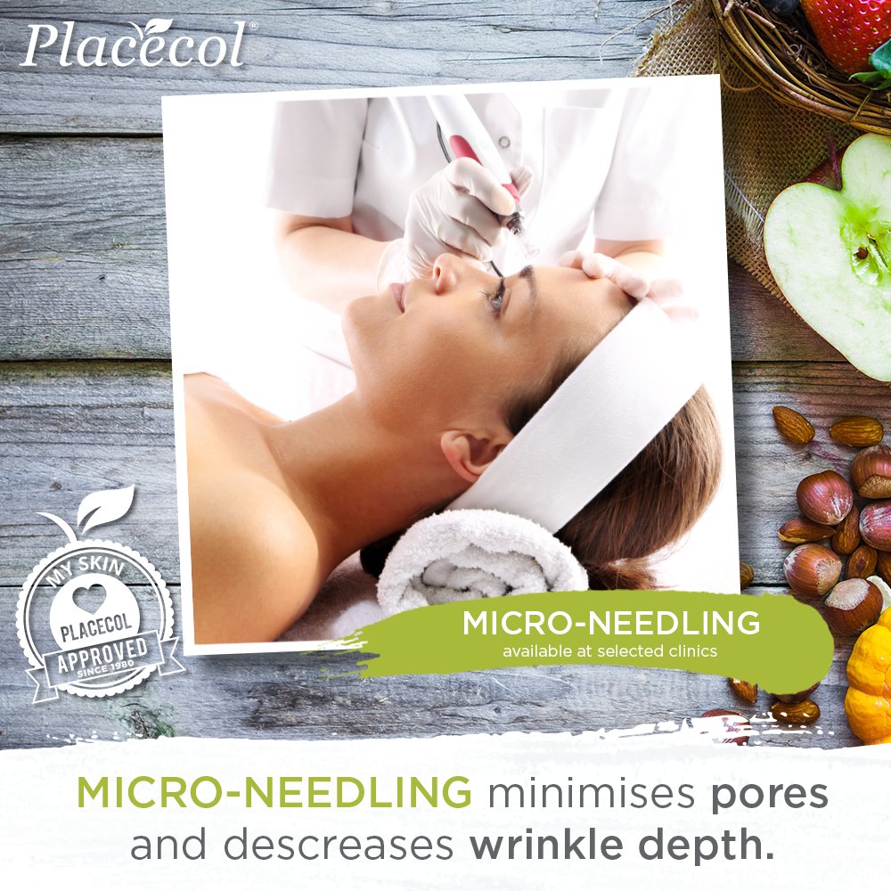 Placecolsa's tweet photo. Get smoother skin! Micro-Needling is now available at selected Placecol Skin Care Clinics. 
#PlacecolSkinCare #Placecol #SkinCare #FoodForYourFace #NurtureByNature #MicroNeedling #MicroNeedlingPen https://t.co/uIuXqZOKmb
