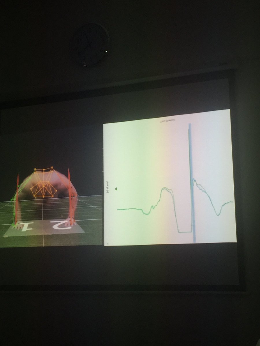 sscsportsmed's tweet image. Using upper body power jumps to analyse dynamic loading asymmetries in the 3D lab during different phases of movement #FSEM2018 #forceplates #kinematics #shouldertesting