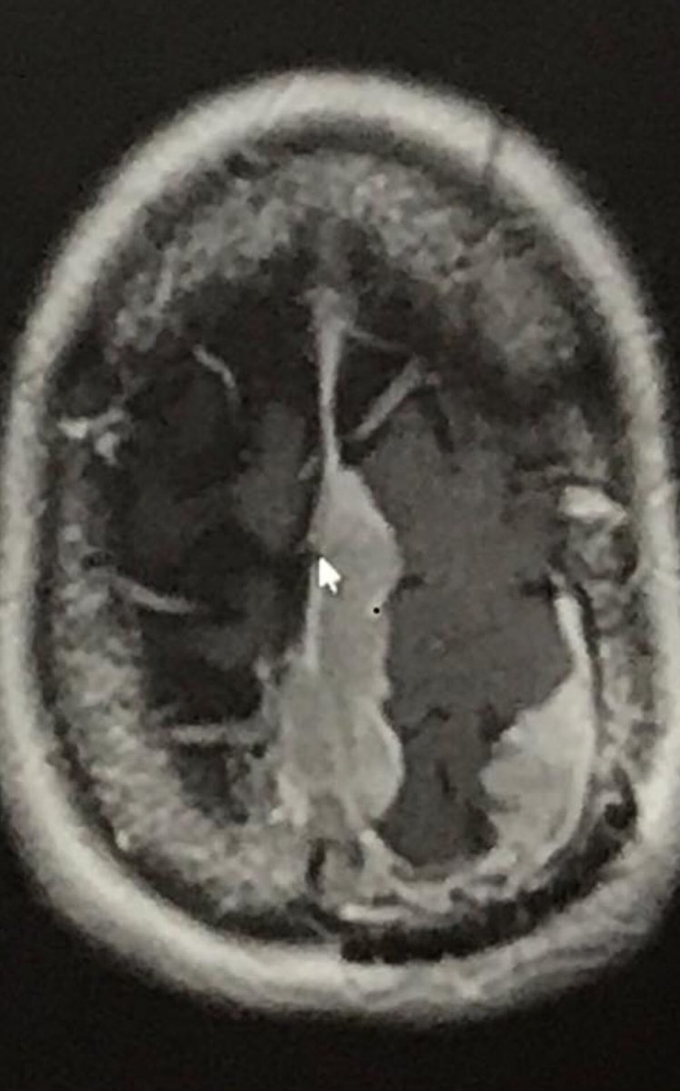 BraintumorSur07's tweet image. @DonnieWahlberg 
#nevergiveup
#notgoingdownwithoutafight
#braintumorawareness