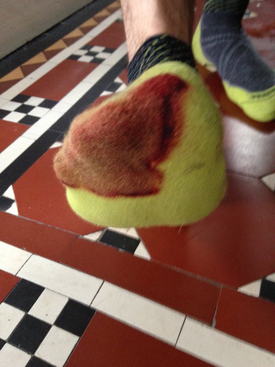 DrDavidWarriner's tweet image. That thing when you need to invoke the major haemorrhage protocol following a 10k run.....  #runningproblems