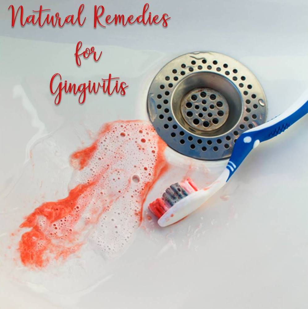 #Natural #Remedies for #Gingivitis - dld.bz/gYY8J #naturalhealth