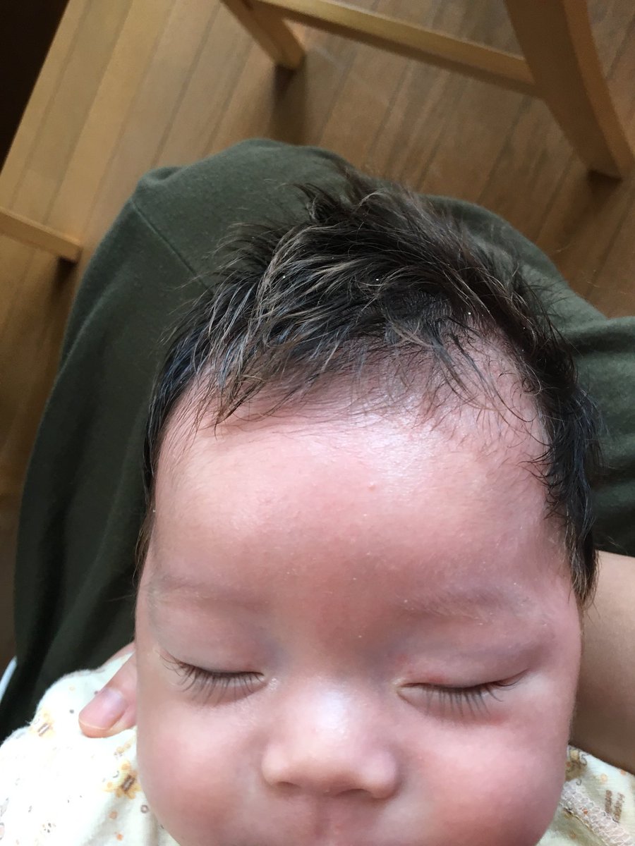 星井サキコ De On Twitter あざます 赤ちゃんは頭が小さい