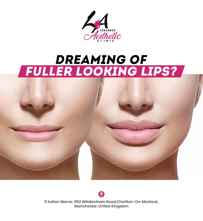 LAClinic_'s tweet photo. Make your dreams a reality with our lip fillers!

#laclinic #lebanese #aesthetic #clinic #beauty #sparkle #bright #attraction #cure #desire #wilabrahamroad #manchester https://t.co/Yu7q8LDGgy