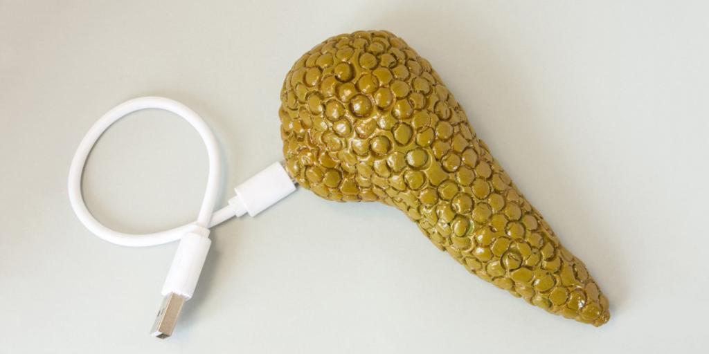 Medscape's tweet image. DIY artificial pancreases save lives. ms.spr.ly/6010rAmjg #OpenAPS