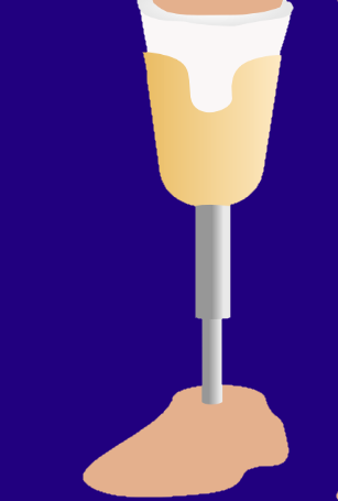 technologytrip's tweet image. On Prosthetic Limbs And Muscle Activation For Amputees #technology #tech #disability # amputee thetechnologytrip.wordpress.com/2018/09/16/on-…