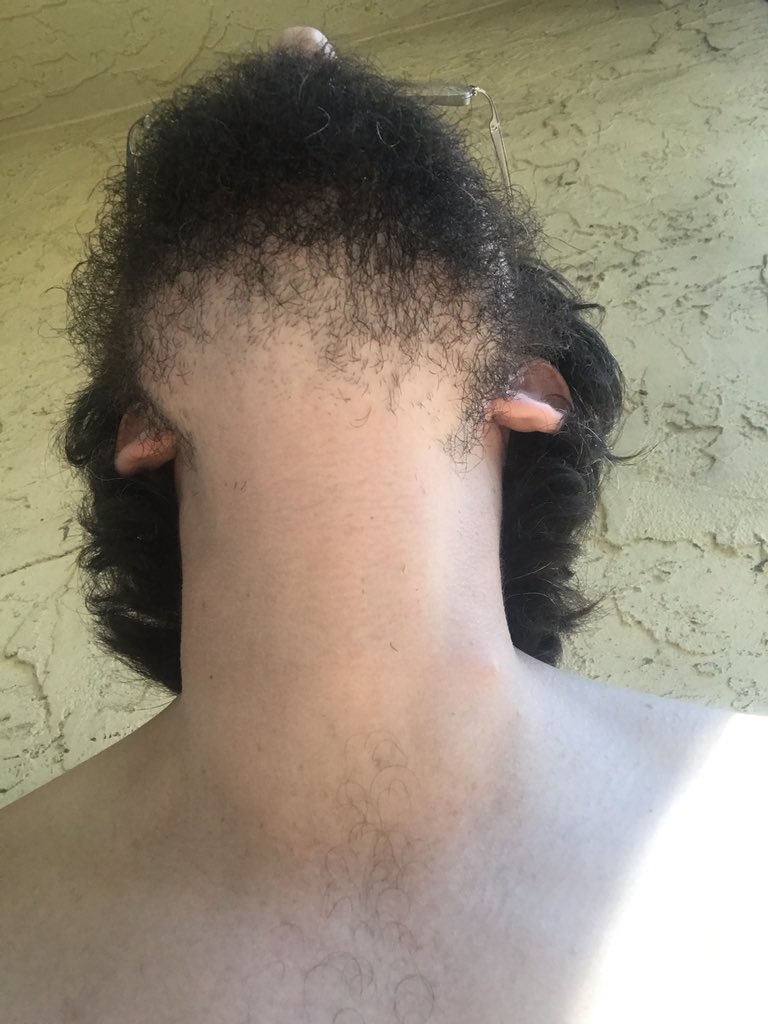 TiMEoFPoSTiNG's tweet photo. This is always sort of a process. Happy to be doing it with an electric razor now, as opposed to my last full-shaves (the intention is ALWAYS to just do the #underbeard, but then I end up with "well, why not be #cleanshaven again?", then letting it grow back, until...this, again) https://t.co/6FBfcsmxd0