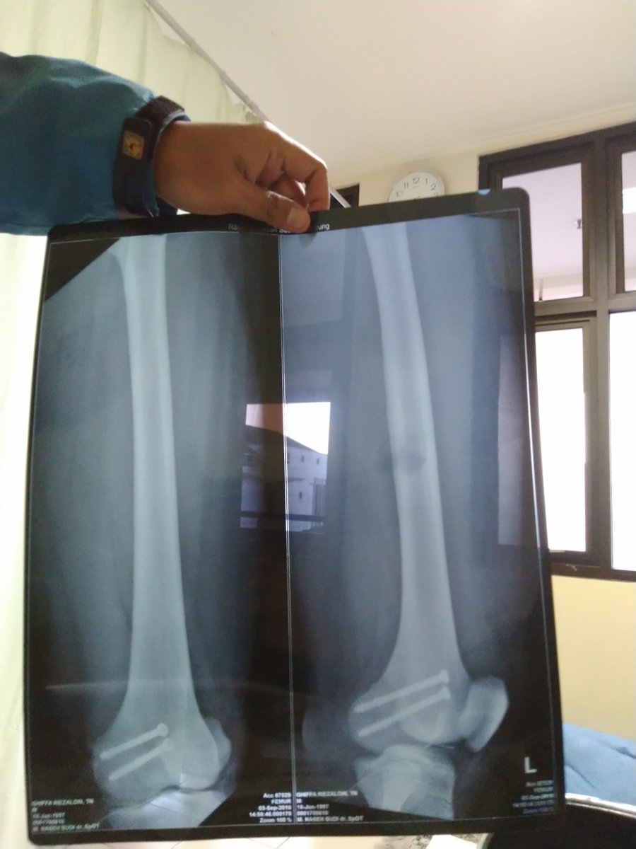 Musibah emg tidak terduga, semua udh kehendak Allah Subhanahu Wata'ala. Semoga ada hikmahnya di balik semua ini🙏🏻🙏🏻🙏🏻