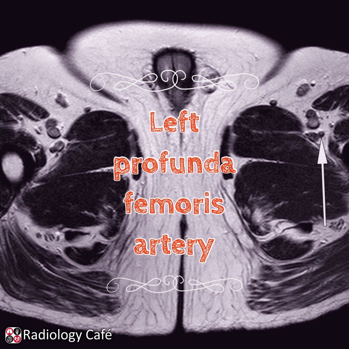 radiologycafe tweet picture