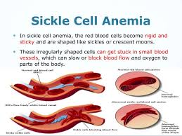 JPrevMed3's tweet photo. Potential #Reduction of Mortality from #Invasive Pneumococcal Infection among Children with #Sickle Cell Disease in Haiti..visit the full article https://t.co/TN40AzC4P8 have any valuable paper for submission??? Submit manuscript to #preventivemed@emedicaljournals.org https://t.co/lEqhC7seu9