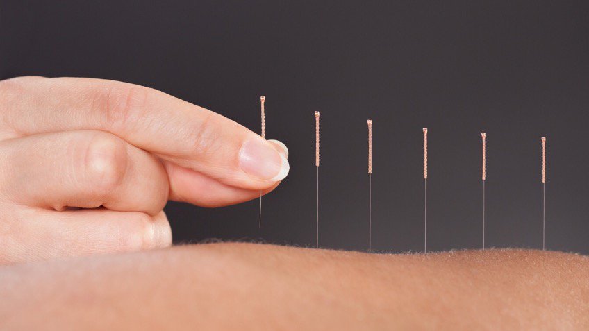 ProPhysio Midlands tweet media