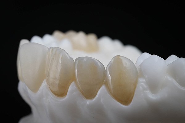 Serranosmilecen's tweet photo. ¿Cómo cuidar la resina dental desde casa? Lee y aplícalo, líbrate de problemas: https://t.co/j4e7MhPEwk Vía: @DentistaEspana #serranosmilecenter #serranodentistas #smilecenter #risas https://t.co/gAJGVRyXkV