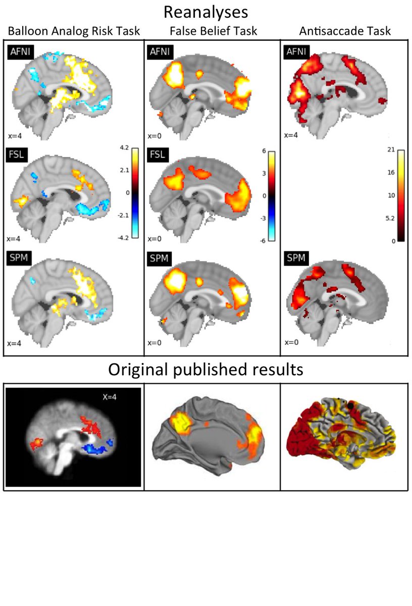 ten_photos's tweet image. Task fMRI software comparison (updated): 3 datasets analysed on AFNI/FSL/SPM, now with greater harmonisation (e.g. all w/ non-linear reg) but still find substantial inter-software differences biorxiv.org/content/early/… w/ @ABNeuroscience @cmaumet