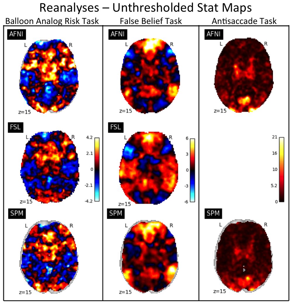 ten_photos's tweet image. Task fMRI software comparison (updated): 3 datasets analysed on AFNI/FSL/SPM, now with greater harmonisation (e.g. all w/ non-linear reg) but still find substantial inter-software differences biorxiv.org/content/early/… w/ @ABNeuroscience @cmaumet