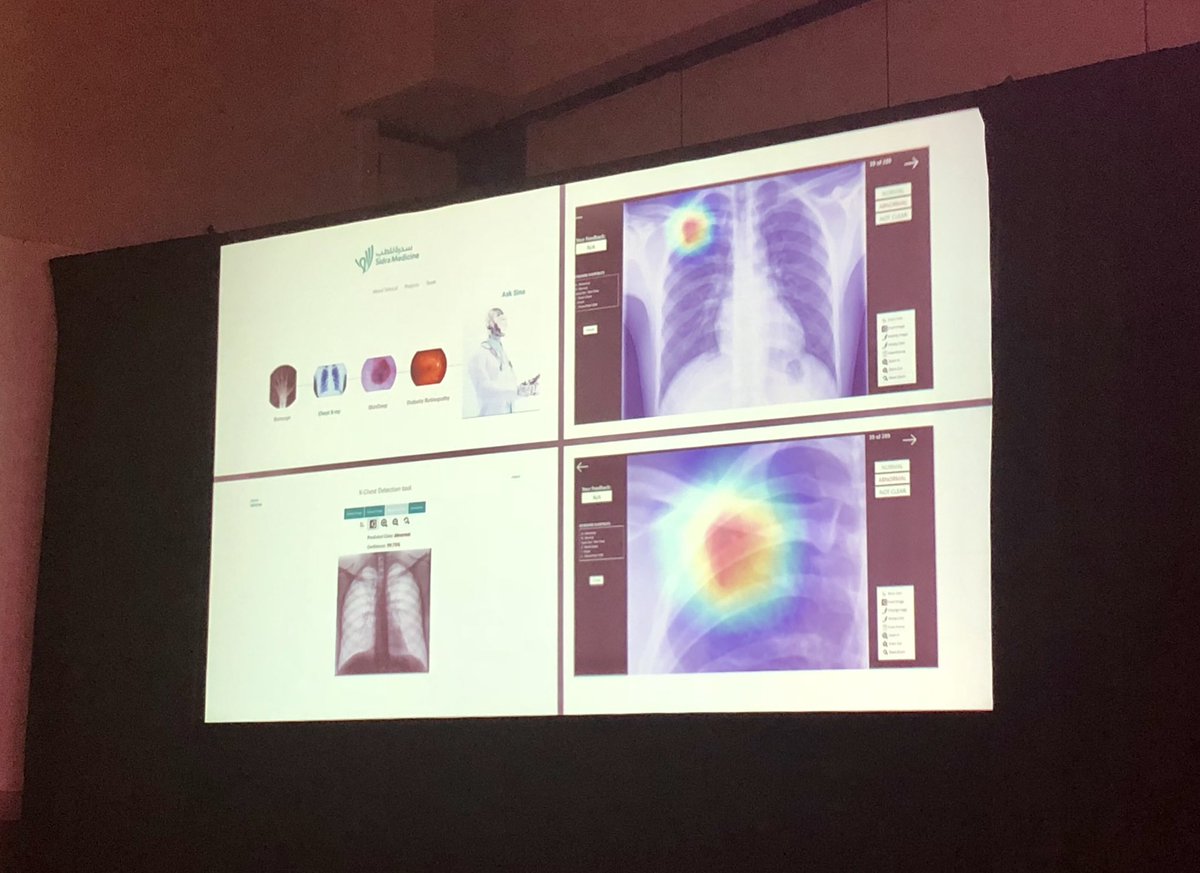 woojinrad's tweet photo. Some great work @AvezR is doing at @SidraMedicine in #healthcare #innovation shared at #NYMIIS2018 #PatientExperience https://t.co/Fh9pZfmVt1
