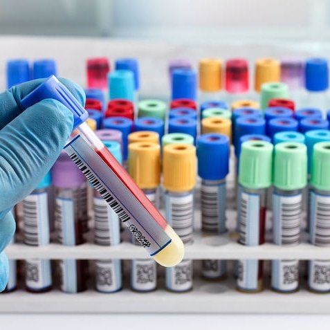 GoodServiceT's tweet image. Necesitas hacerte una analítica? Llámanos. #cuidamosdeti