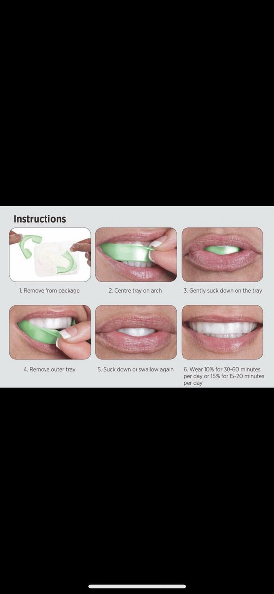 BoCampbells's tweet photo. If anyone is interested I am selling professional whitening kits! The kit is $45 and it includes 10 whitening trays. Part of the cost of these whitening kits goes towards paying for my board exams. The money is due by November 1st. Let me know if you’re interested! Thank you!! https://t.co/Z6TRE5fxG4